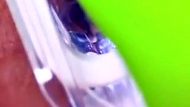 Vagina, cervix Rhythmically hit the orgasm vaginal endoscope with strong suction, squeezing and raising the spike.